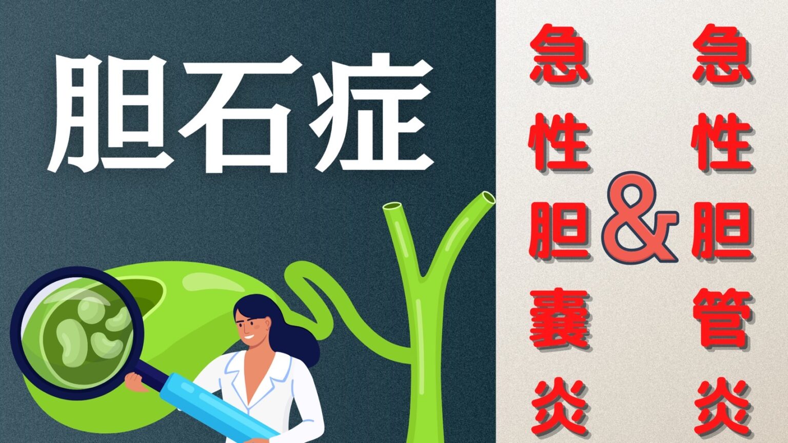 急性胆嚢炎を伴う胆嚢結石の診断