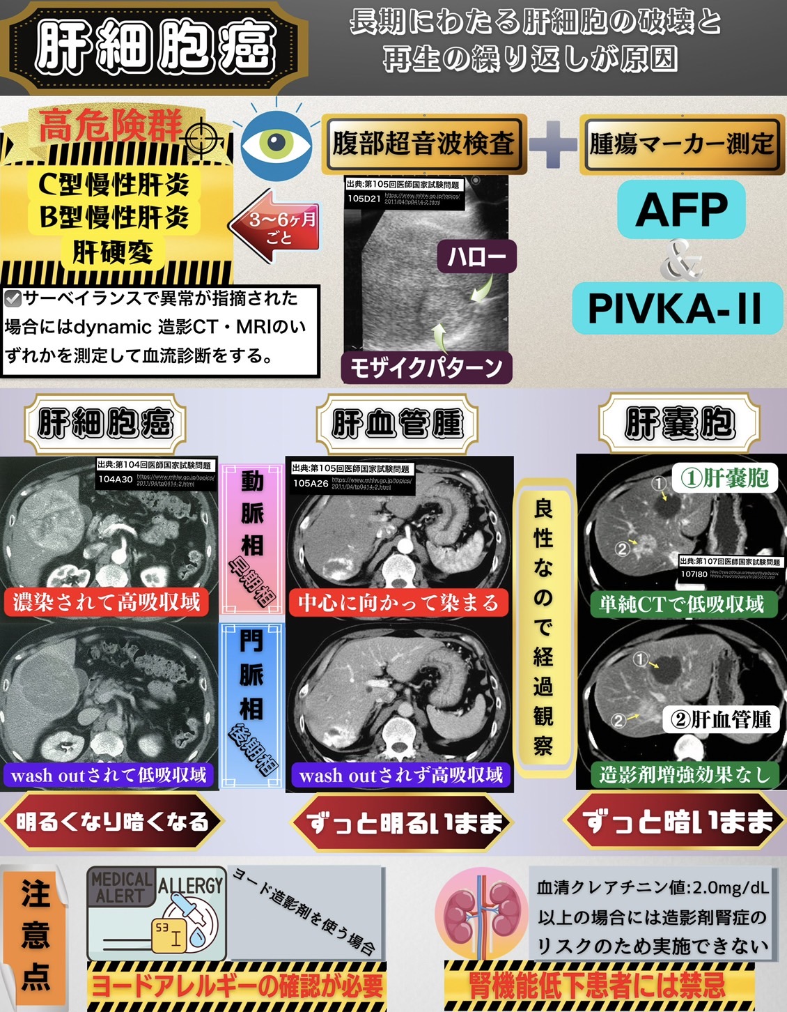 肝細胞癌について | 医学ノート